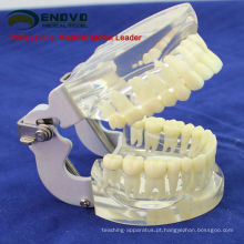DENTAL12 (12572) modelo mandíbula transparente com dentes para auto escovação Educaion